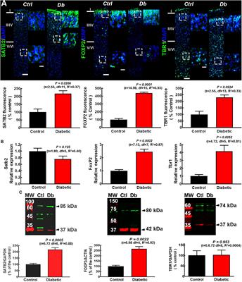 Impaired Cortical Cytoarchitecture and Reduced Excitability of Deep-Layer Neurons in the Offspring of Diabetic Rats